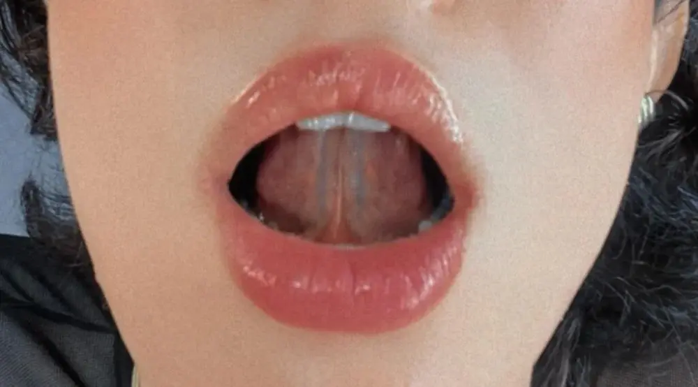 Erelisstrip